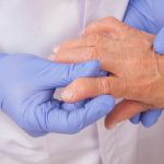 Rheumatoid arthritis and lupus confusion