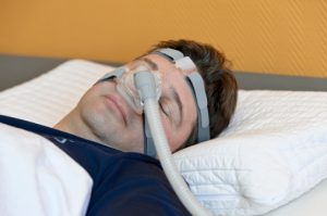 Sleep apnea, sleep disordered breathing (SBD) and stroke risk