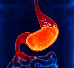 What conditions can cause abdominal gas pains?