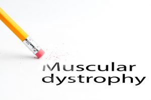 What are some causes of muscular atrophy?