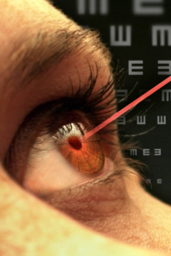 Is Laser Surgery Really Safe?