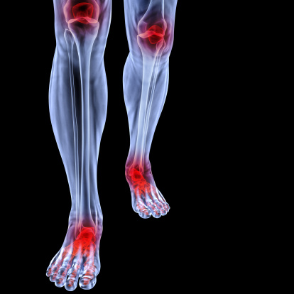 Improve Joint Health: Causes, Di...