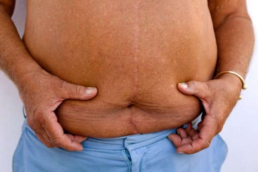 Age Related Obesity: Brown Fat F...