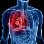 How does COPD affects your lungs?