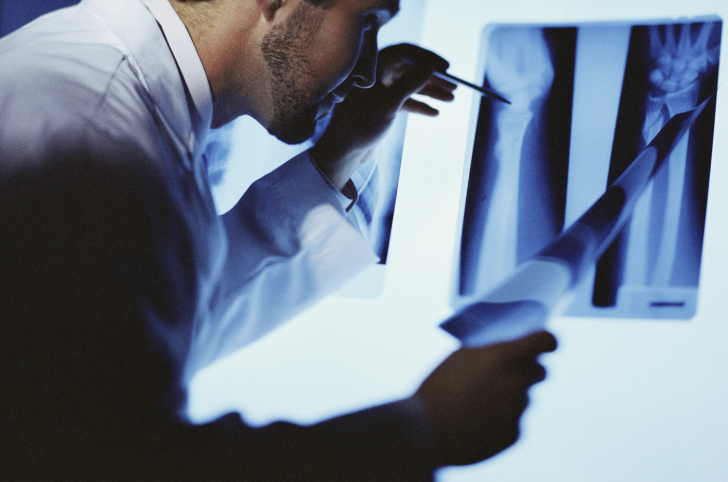 7 Quick tips to improve your bon...