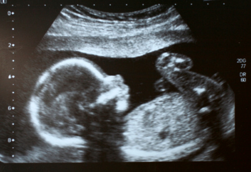 Video on alleged fetal tissue sa...