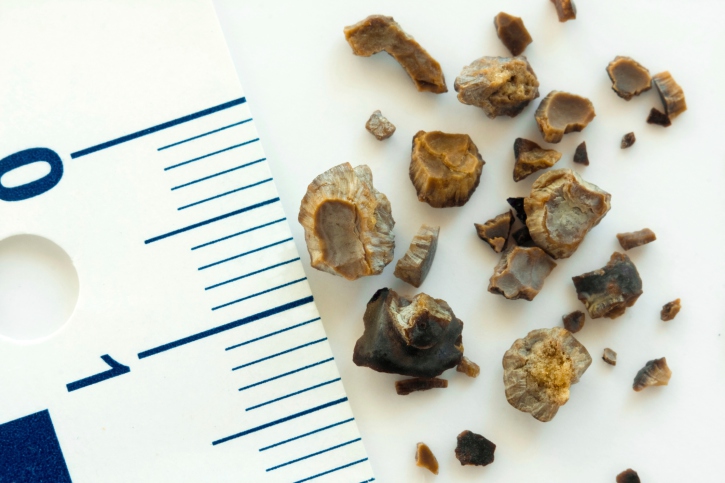 Postmenopausal women’s risk of o...