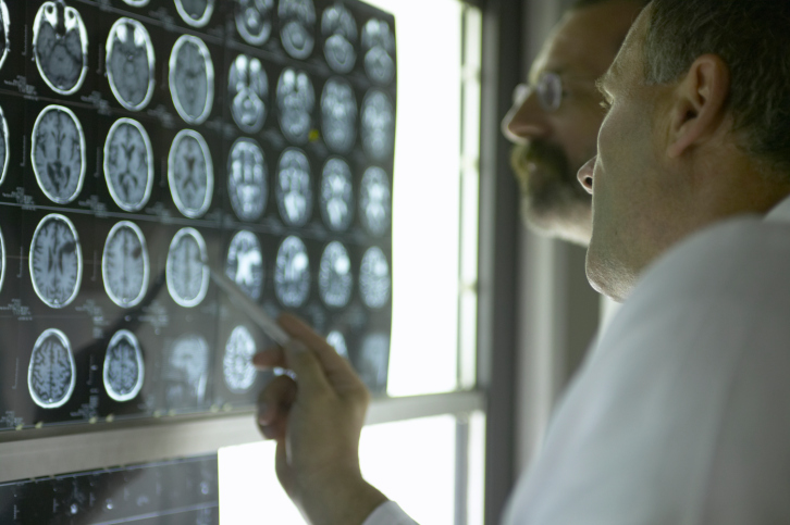 Brain abnormalities found in peo...