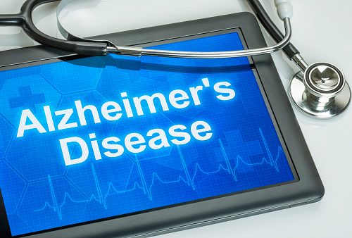 Iron containing cells in brain of alzheimer's patient