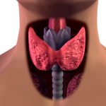 causes of Thyroid nodules
