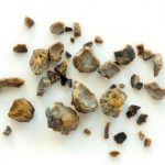 Vitamin D and kidney stone disease