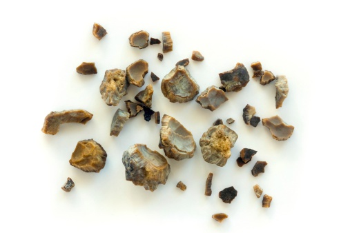 Large kidney stones improve with...