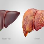 How proteins may help in liver regeneration