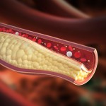Effects of cholesterol on the body