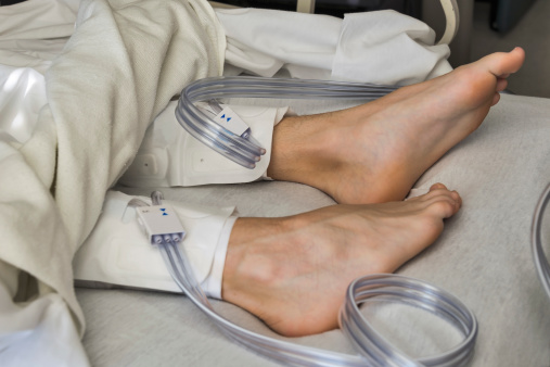 Deep vein thrombosis (DVT): Caus...