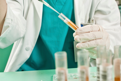 Pancreatic Cancer detected with ...