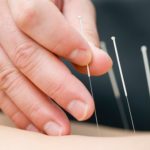 Additional health benefits of acupuncture