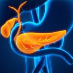Symptoms and causes of chronic pancreatitis