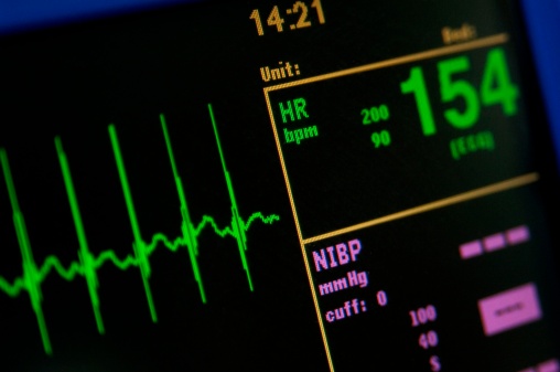 Facts about heart palpitations