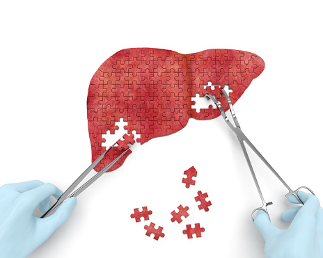 Hepatitis C responsible for more...