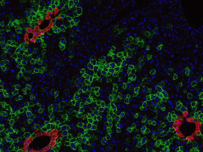 Liver’s stem cell source identified