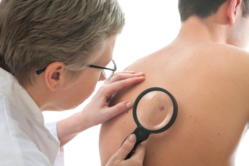 Deadly melanoma trigger discover...