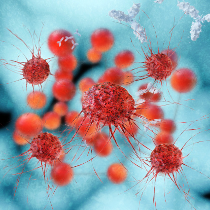 Ovarian cancer recurrence reduce...