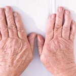 Study finds gene similarities for Sjögren’s syndrome, rheumatoid arthritis and lupus