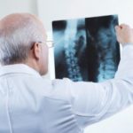 Other risk factors and symptoms of osteonecrosis
