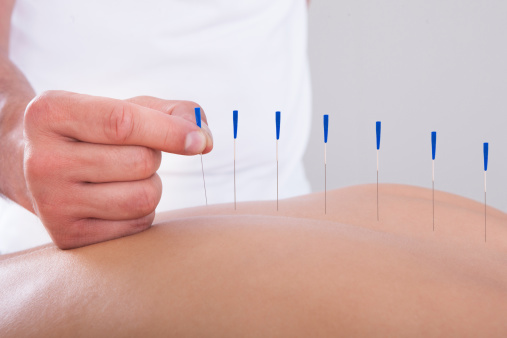 Acupuncture: The answer to side ...