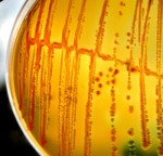 E. coli infection and enteritis