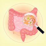 Gut bacteria and colon cancer risk