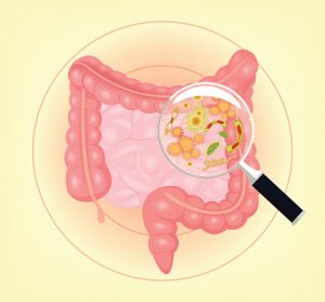 Increasing good gut bacteria is easier with healthy food choices