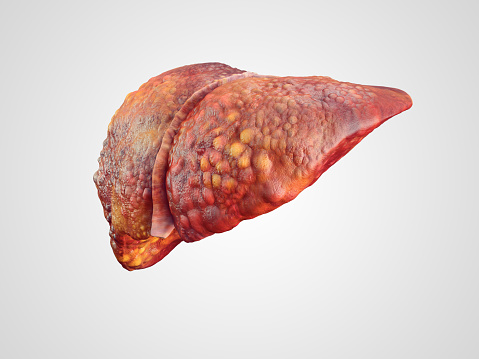 Signs of a toxic liver