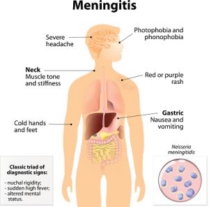 Aging adults at risk for meningitis, too