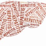 Delaying HCV therapy can lead to advanced liver diseases
