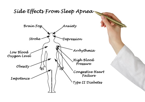 Obstructive sleep apnea can caus...