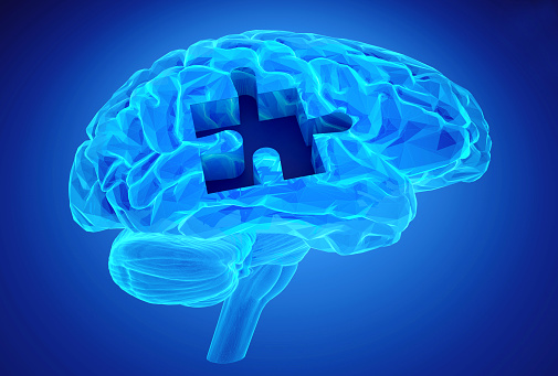 Alzheimer’s disease could be con...