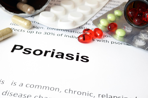 Link between psoriasis and risk ...