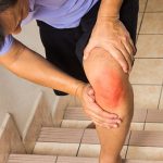 How rheumatoid arthritis affects the synovium