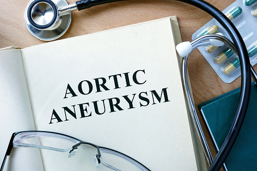 Abdominal aortic aneurysm treatm...