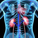 Polycystic kidney disease treatment