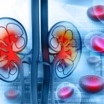 Albuminuria, a risk factor for anemia in chronic kidney disease