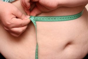 overweight women stomach