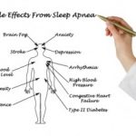 Sleep Apnea and Brain Damage
