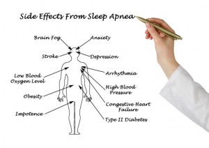 Sleep apnea health news roundup ...