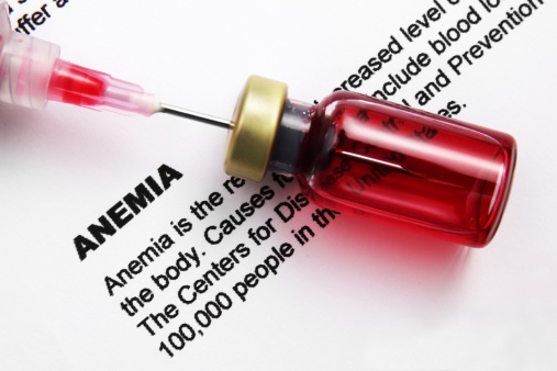 Anemia, iron deficiency linked t...