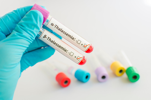 Thalassemia, sickle cell disease...