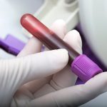 Pernicious anemia diagnosis