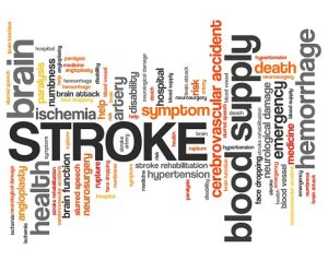 stroke may cause memory loss and cognitive decline